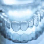 Is Invisalign Right for Me?