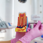 Restore comfort with root canal therapy in Airdrie. Visit our clinic for precise, stress-free root canal therapy near you.