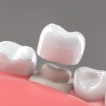 can you still get a dental crown with a missing tooth