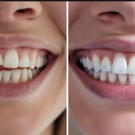 patient smiling confidently after receiving natural looking dental dentures